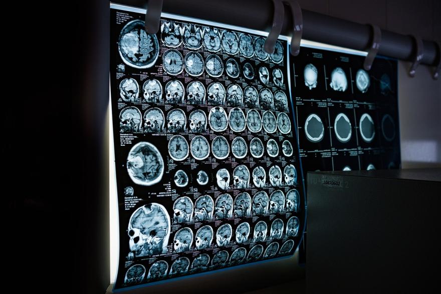 Samsung, Deloitte units back medical AI startup PocketHealth Samsung, Deloitte units back medical AI startup PocketHealth